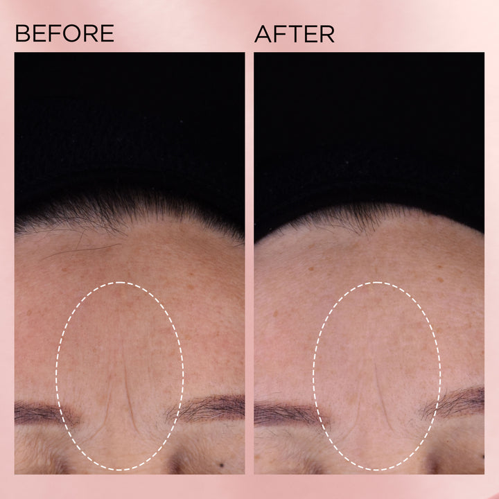 Retinol + HPR Ceramide Capsules Rapid Skin-Renewing Serum